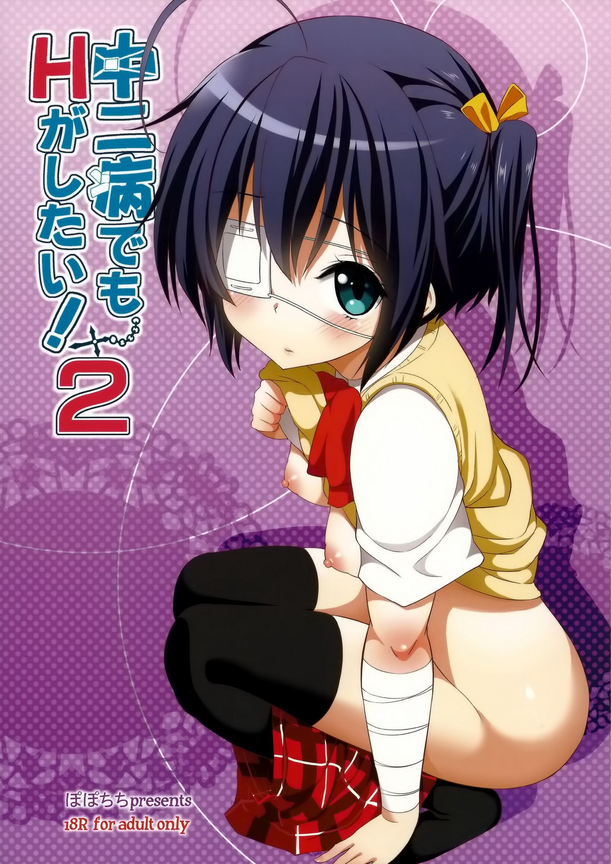Chuunibyou Demo H ga Shitai! 2 page 26